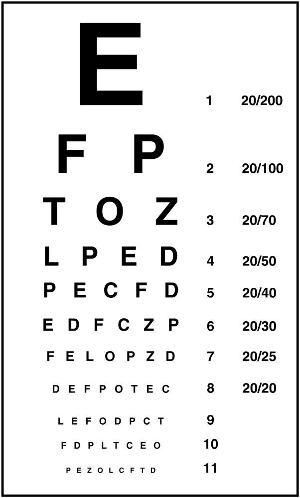 exame de vista
