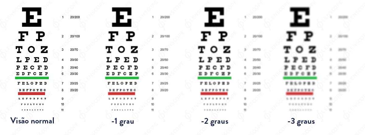 gradele de miopie dacă vă smulgeți vederea vă deteriorează
