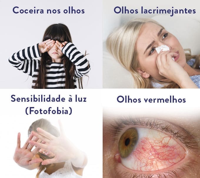 síndrome do olho seco