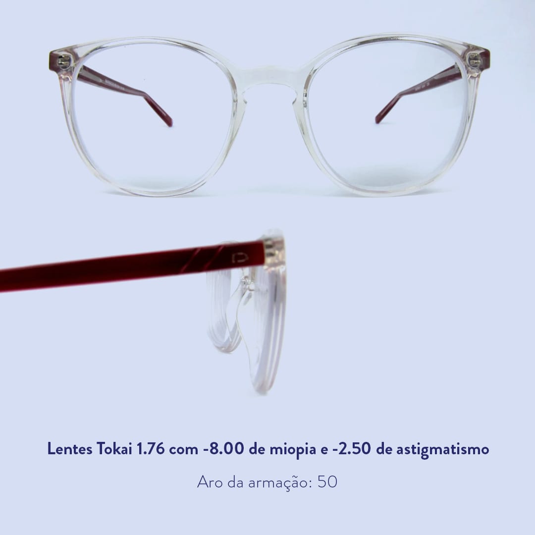 óculos com -8 graus de miopia e -2,50 graus de astigmatismo