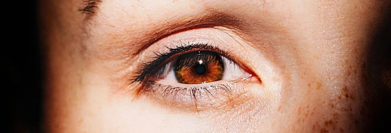 Oftalmoplegia causas, sintomas e tratamentos Lenscope