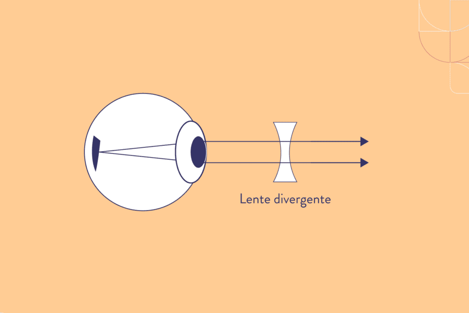 lente para corrigir miopia