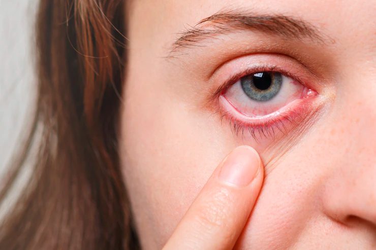 Teste de Schirmer: o que é e como funciona o teste do olho seco