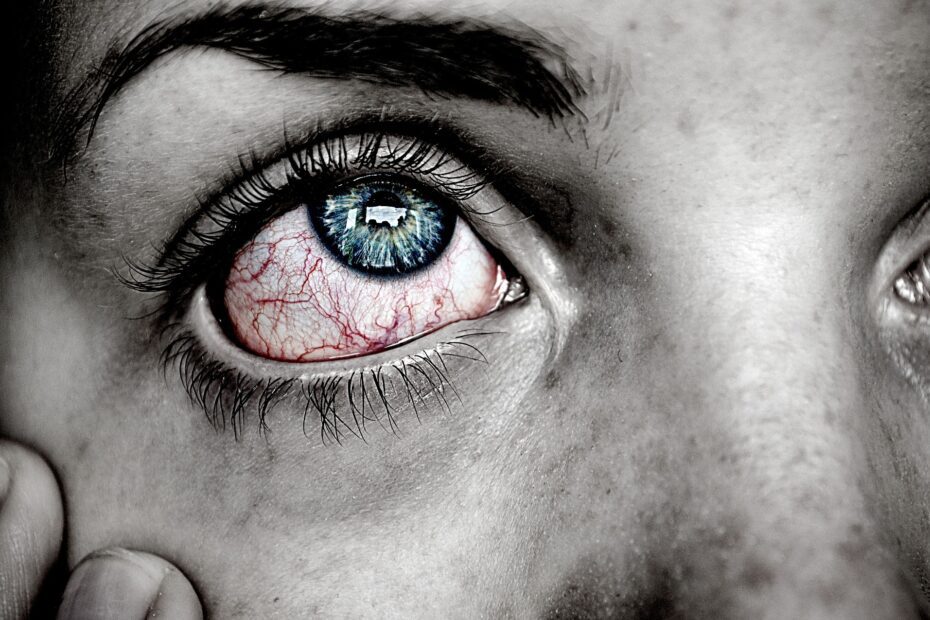 Cicatriz no olho tem cura? Causas, sintomas e tratamentos