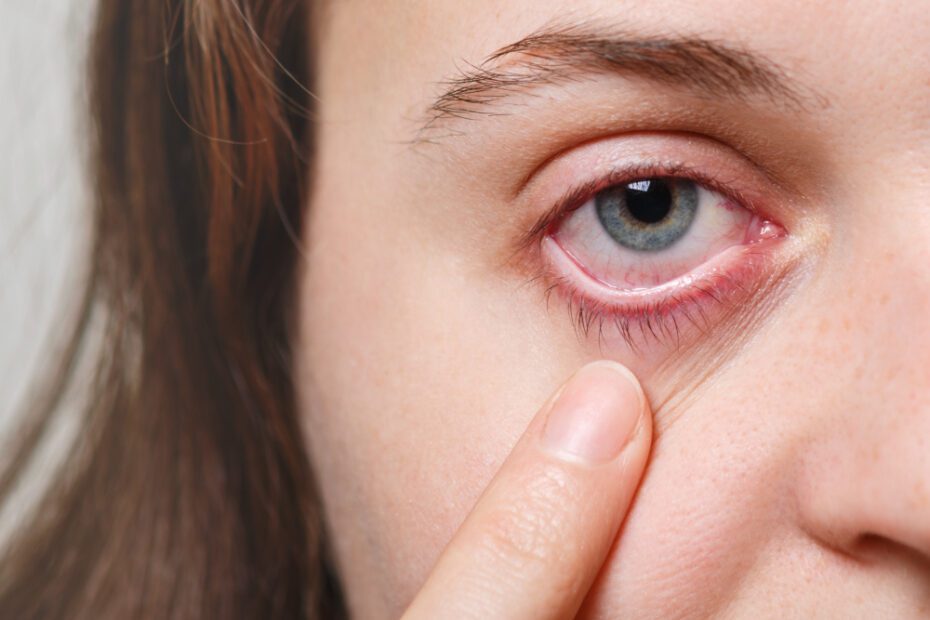 Principais tipos de lesões oculares, como tratar e prevenção