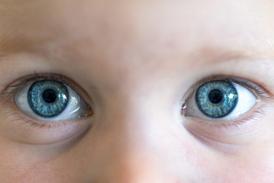 Buftalmo: o que é, causa principal, sintomas e tratamento