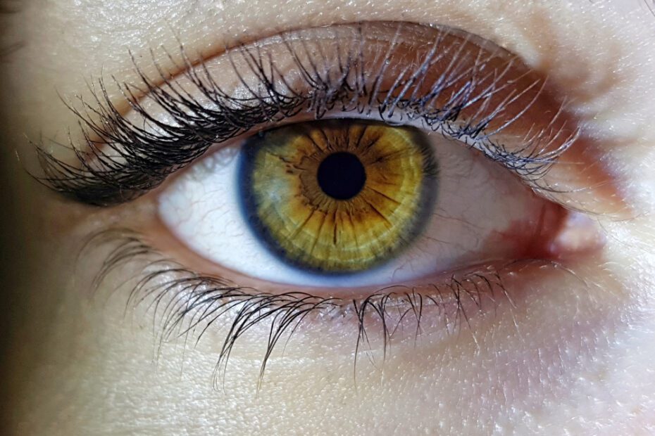 Melanose ocular: descubra o que é, tipos, sintomas e como tratar